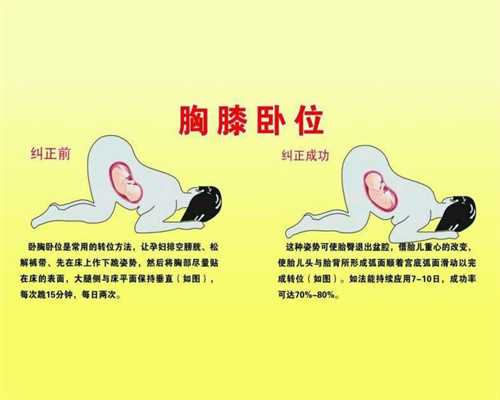 如何做南京代孕:试管婴儿做几次才能成功提高成