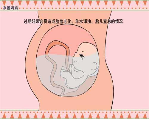 南京代孕包成功哪家便宜:中医建议有妇科炎症的