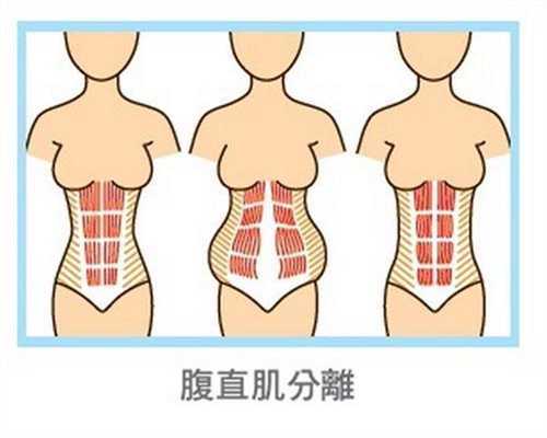 南京代孕之母:银屑病患者可以怀孕吗要注意了
