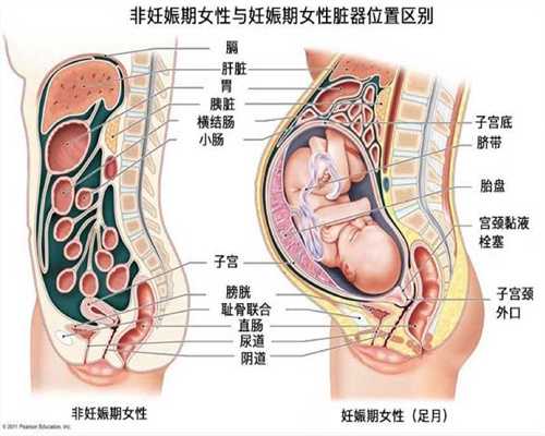 国内南京代孕户口:坚持治疗，子宫内膜异位症也