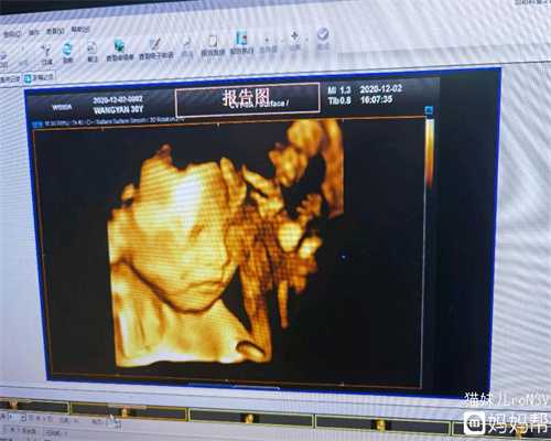 南昌中国代孕机构南昌试管胚胎怀孕期间吃什么