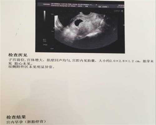 南昌职业代孕-南昌代孕得花多少钱-南昌香港捐卵代孕包成
