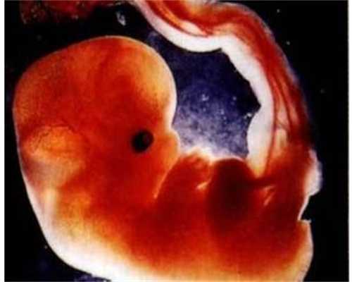 南昌代怀孕哪里有卖_胎宝宝在孕妇肚子里看到吗